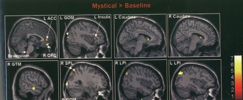 fmri-scan